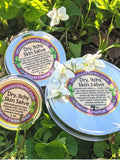 Three round metal tins of Missouri Herbs Dry, Itchy Skin Salve placed outdoors among green leaves and white flowers. The tins have light blue lids with circular labels showing the product name and website.
